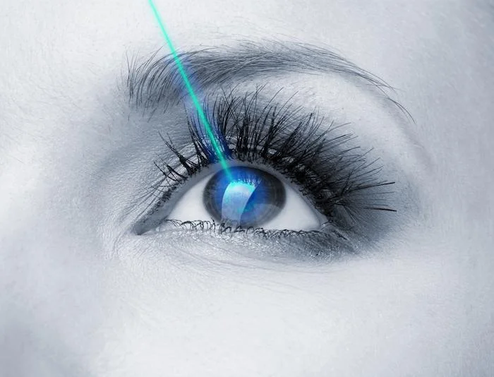 What Are the Benefits of Laser Eye Surgery