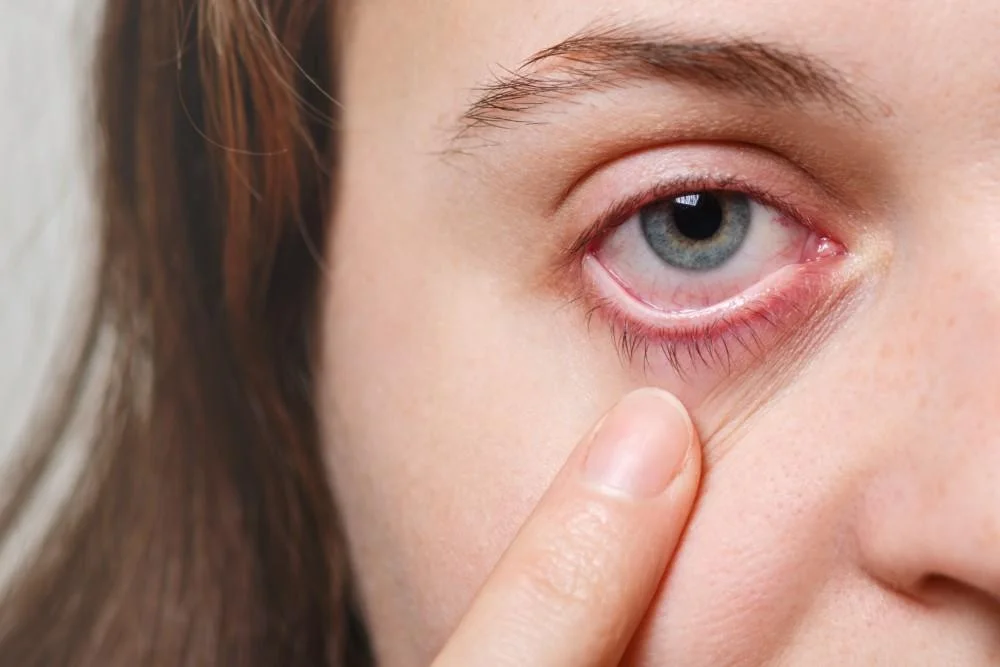 Red Eyes: Signs of A Serious Condition