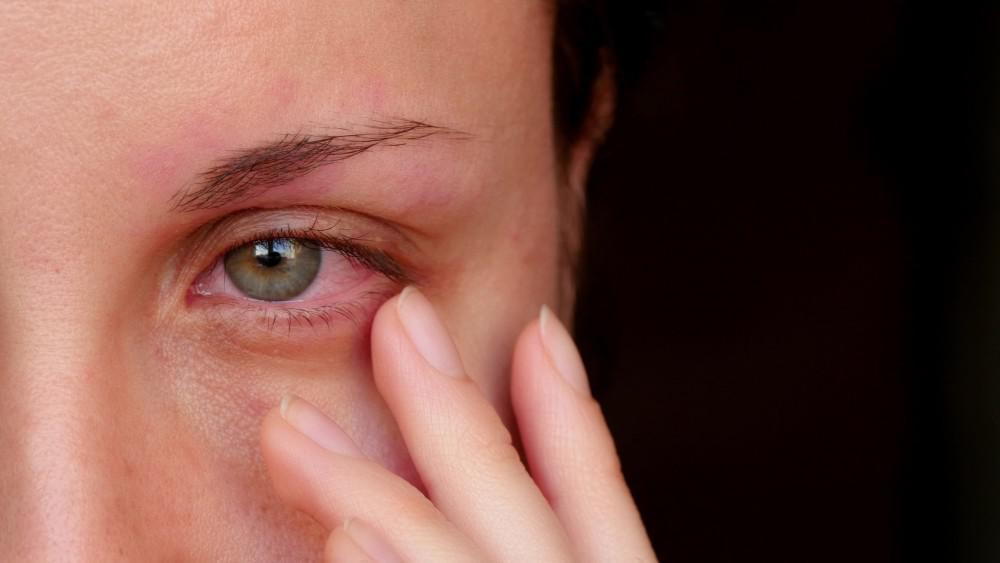 How Does Menopause Cause Dry Eyes?