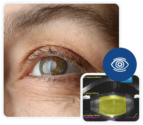 Eye-Associates-of-Monmouth-Cataract