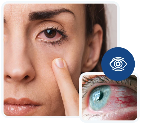 Eye-Associates-of-Monmouth-Red-Eyest